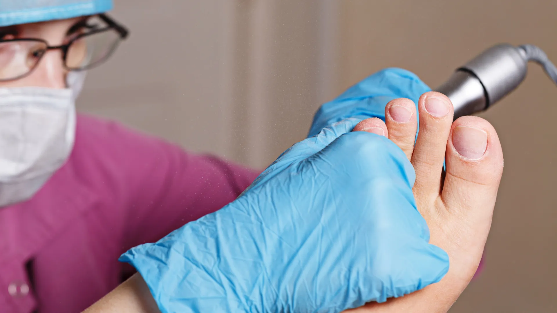 Eliminar callo y dureza